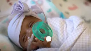California Gives Birth to the World's Tiniest Surviving Baby