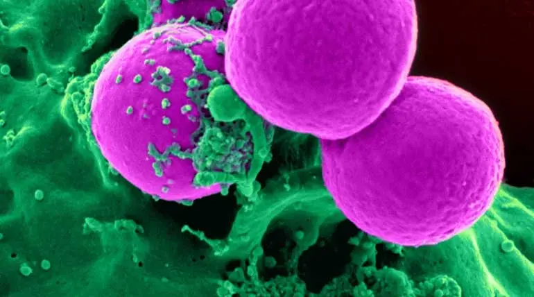 Science Turns to Nature For Cancer Cure - Solar Power Kills Cancer Cells