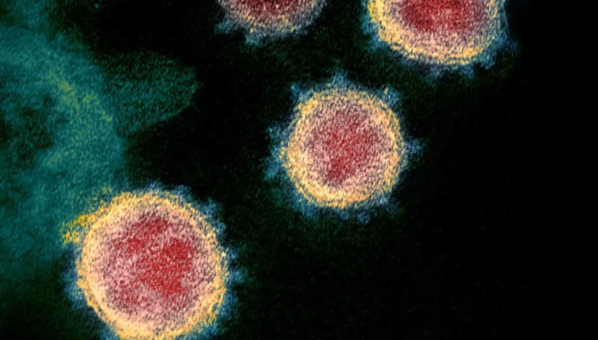 Lockdowns alone cannot be a solution to defeat Coronavirus