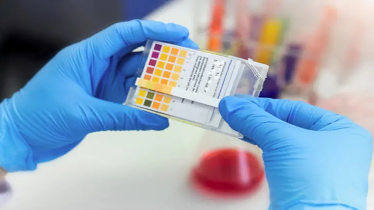 Do the low price Feluda test kit by TATA sustain in the Market?