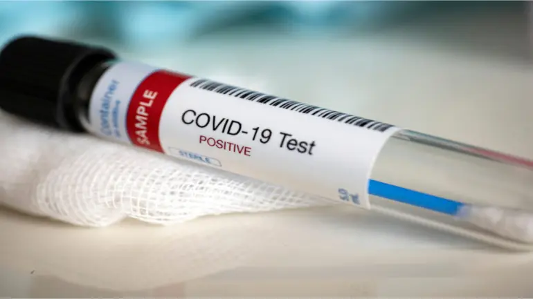 Reliance Introduces The COVID19 Testing kit that Provides Results in 2 Hours.