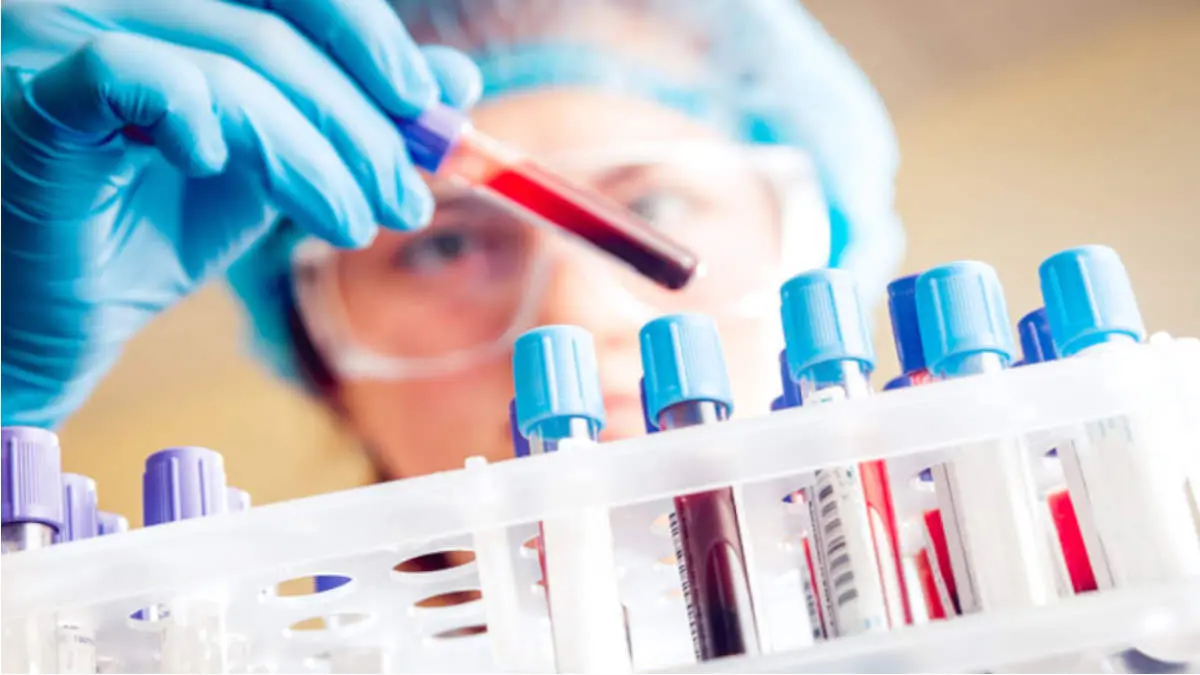 COVID 19 : Saliva test to control risk of outspread.