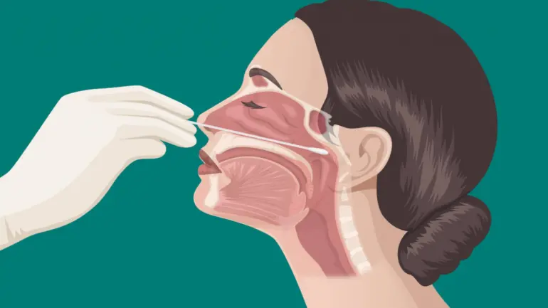 Alert: Nasal Swab Could Damage The Brain