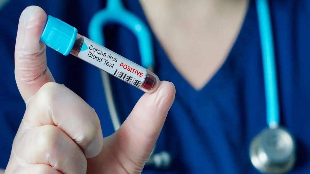 COVID 19 Update Oct 30 : So far 6.87 lakh people were recovered from COVID19.