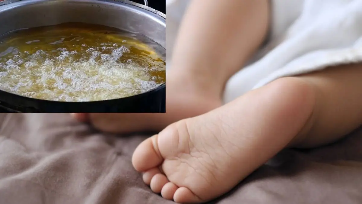One And Half Year Bavishka Fell In Hot Oil And Burns To Death In TN