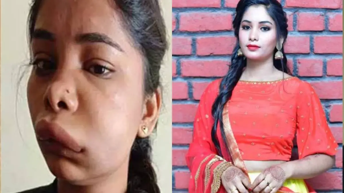 Kannada Actress Swathi Swollen Face After Taking Treatment For Tooth