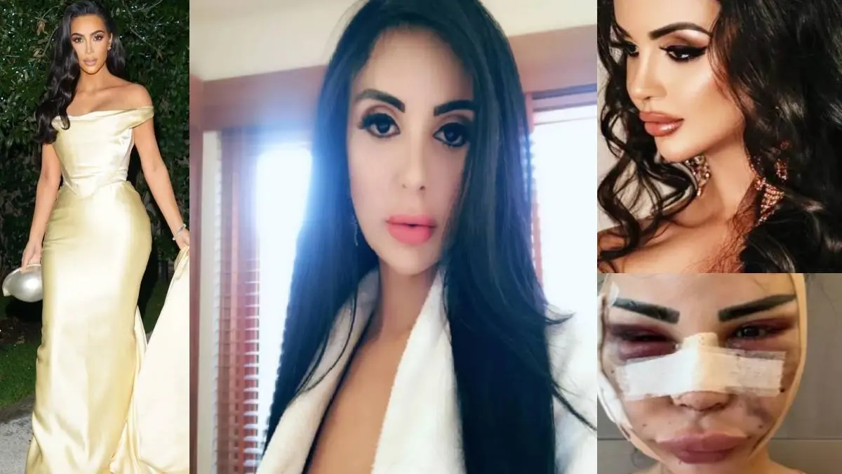 Brazilian Model Pamplona Surgery To Look Like Kim Kardashian Failed