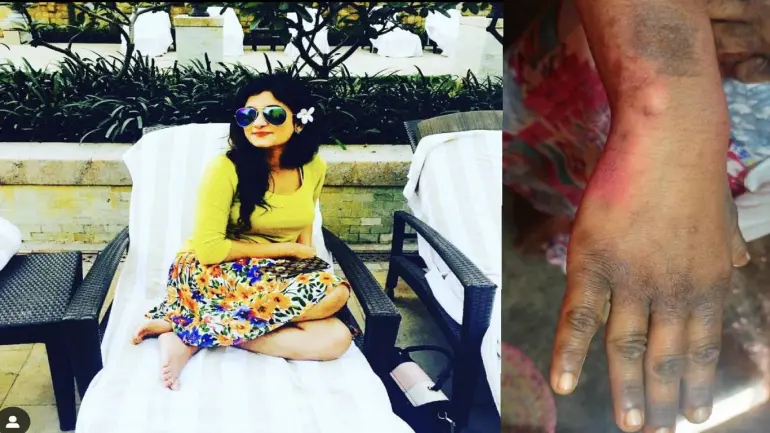 Justice For Rekha: MLA Son Anto Mathivanan And Merlina Physical Abuse