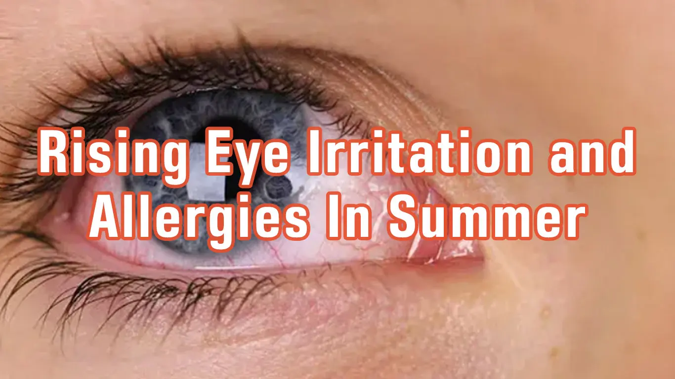 Doctors Warn of Rising Eye Irritation and Allergies In Summer