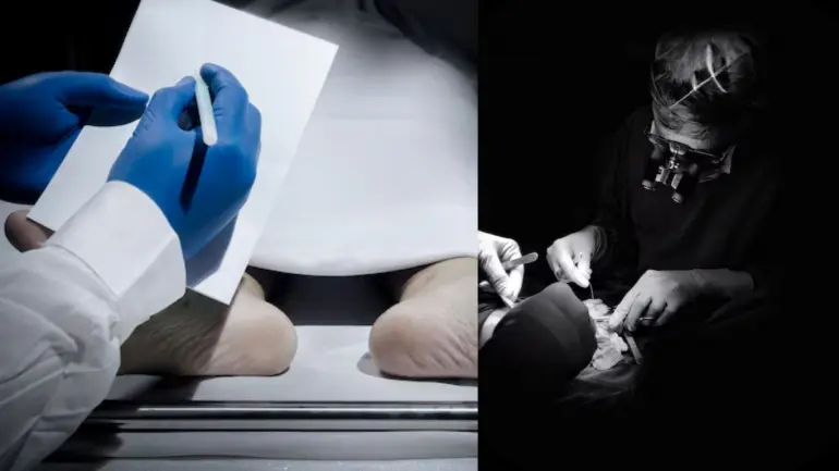 Bihar Fake Doctor: YouTube Surgery Gone Wrong, Teen Loses Life