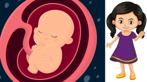Parasitic Twin Surgery